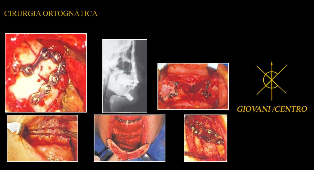 Centro de Pesquisa Osseo-Craniofacial � Cirurgia Ortognatica ... photo